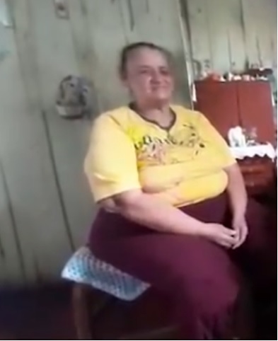 DRAMA PARA MUJER AFECTADA CON ELEFANTIASIS EN SAMAN�
